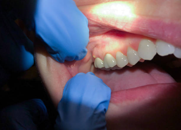 Best Urgent Dental Care for Toothache in Parker City, IN