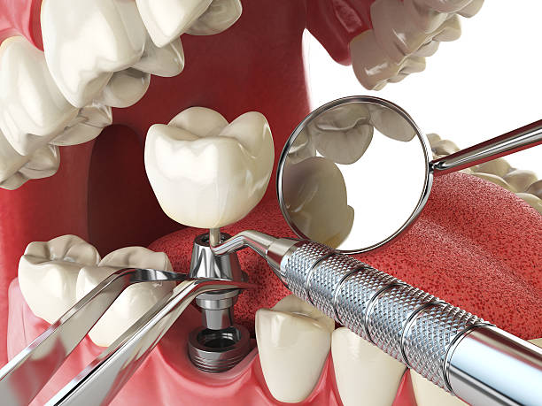 Best Weekend Emergency Dentist in Parker City, IN